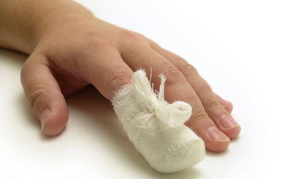 Травма ногтя на руке лечение