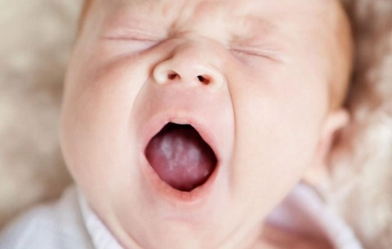 Появление молочницы во рту у новорожденных и его лечение. Как диагностировать молочницу во рту у новорожденного и каким может быть лечение заболевания