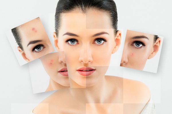 10 сигналов кожи лица о том, что в вашем организме присутствуют неполадки