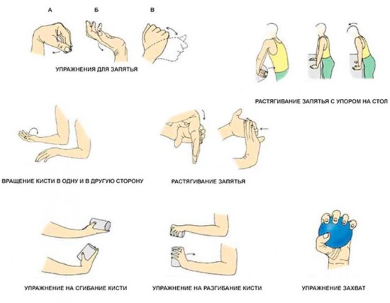 Упражнения для восстановления подвижности руки после перелома
