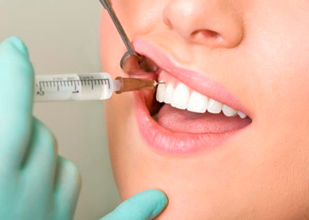 Популярные стоматологические процедуры: стоит ли делать?