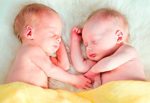 Близнецы, рожденные в результате ЭКО, значительно чаще испытывают проблемы со здоровьем