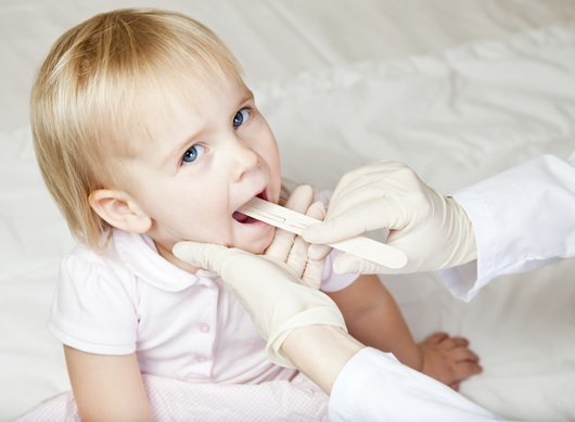 Что-то белое во рту? Как лечить молочницу во рту у ребенка.