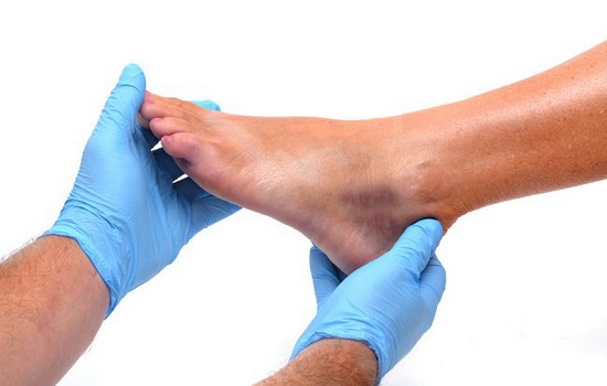Болит мизинец на ноге – это очень опасно? Почему болит мизинец на ноге, первая помощь, к какому врачу идти и как это лечится