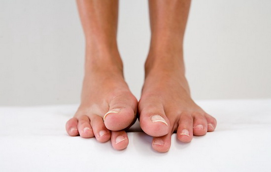 Почему болят суставы больших пальцев ног: серьёзный симптом. К кому обращаться при боли в суставе большого пальца на ноге