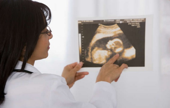 Маловодие при беременности – сказывается ли на родах? Как избавиться от маловодия при беременности и при этом не потерять своего малыша?