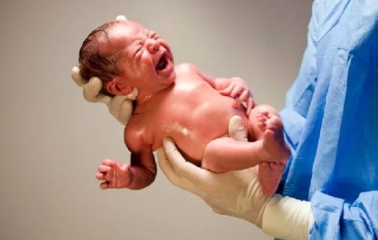 Шкала Апгар – как проводится оценка новорождённых? Как влияет оценка по шкале Апгар на будущее здоровье ребёнка