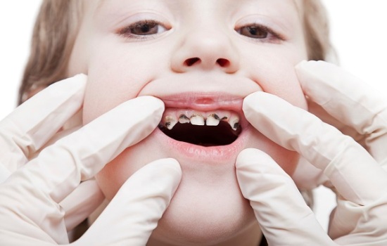 К чему снятся гнилые зубы, вырывать зубы во сне? Основные толкования - к чему снятся гнилые зубы мужчине или женщине