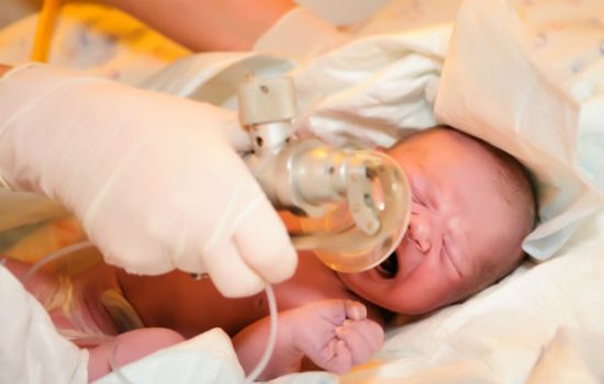 Каковы причины и симптомы асфиксии у новорожденных? Что делать при асфиксии у новорожденных, как преодолеть последствия