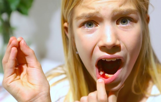 К чему снятся зубы с кровью: во рту или на ладони? Основные толкования - к чему снятся зубы с кровью по толкованию разных сонников